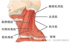 痉挛性斜颈可以自愈